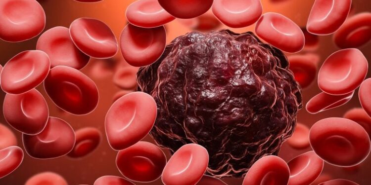 AI Blood Cell Analyzer Outperforms Human Experts in Detecting Leukemia