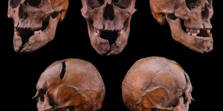 Archaeologists Solve 700-Year-Old Mystery of Murdered Hungarian Duke