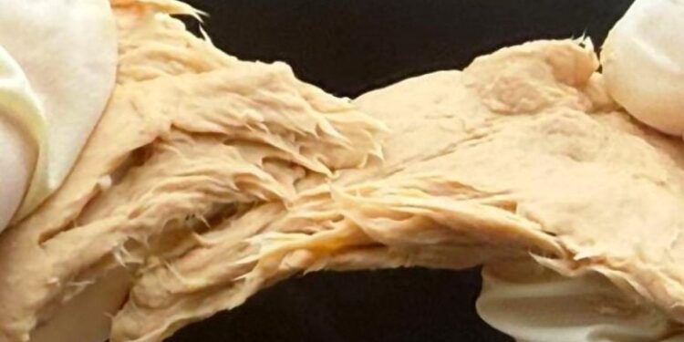 CRISPR Supercharges a Meatlike Fungus Into a Sustainable Protein Powerhouse