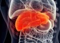 Everyday Chemical Linked to Liver Disease and Cancer, Study Warns