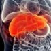 Everyday Chemical Linked to Liver Disease and Cancer, Study Warns