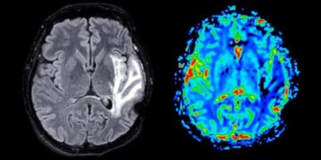 This Is What Happens in Your Brain During a Soccer Match