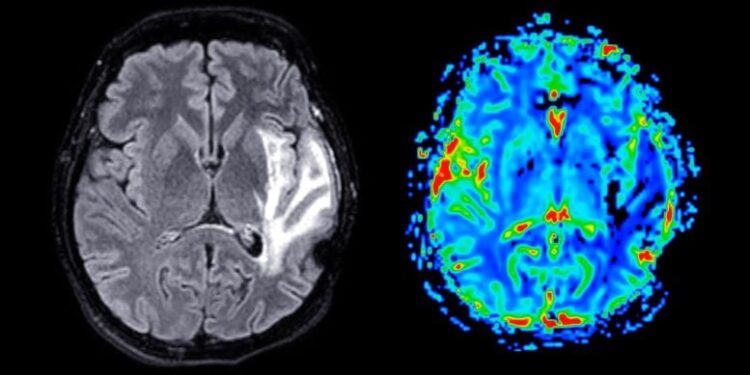 This Is What Happens in Your Brain During a Soccer Match