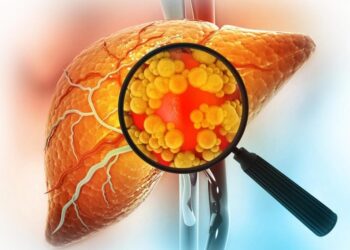 Mayo Clinic Discovers Genetic Twist That Rewrites Rules on Common Liver Disease