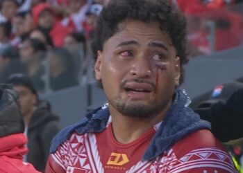 Tonga star surgery to relieve pressure on brain, uncle gives health update, calls for change