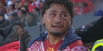 Tonga star surgery to relieve pressure on brain, uncle gives health update, calls for change