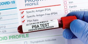 Prostate cancer: NHS screening programme could come one step closer today | UK News