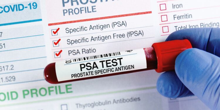 Prostate cancer: NHS screening programme could come one step closer today | UK News