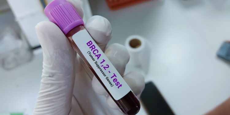 Why prostate cancer is expected to be left as the only major cancer without national screening | Science, Climate & Tech News