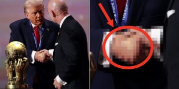 Trump’s Bruised Hand Is Looking Pretty Swollen