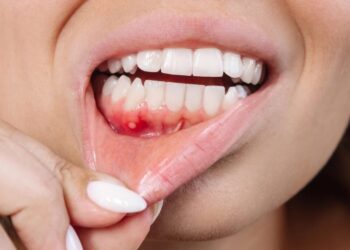 This Common Dental Problem Could Threaten Your Brain