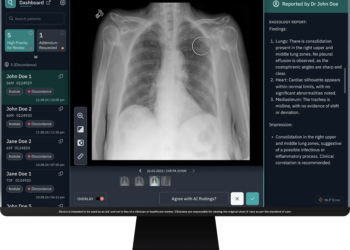 How Horizon Health and Qure.ai Are Using AI to Catch “Incidental” Lung Cancer