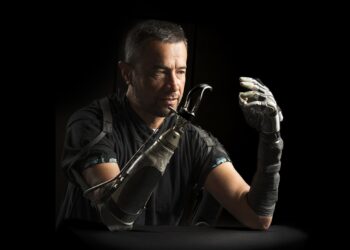 Amputees often feel disconnected from their bionic hands. AI could bridge the gap : Shots