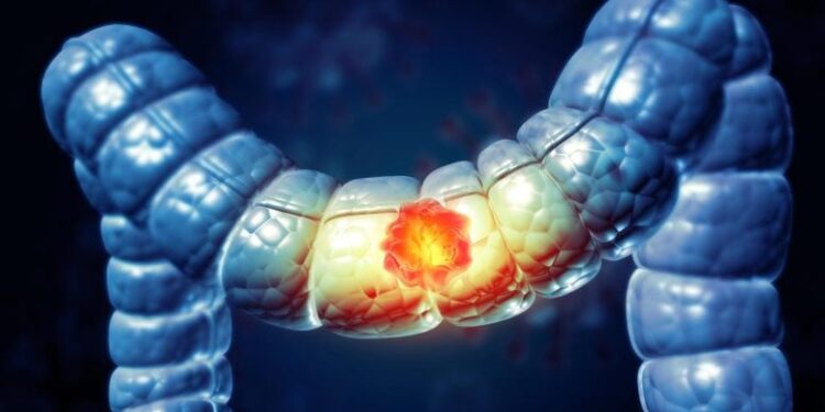 Alcohol’s Hidden Cancer Risk Builds Over Time