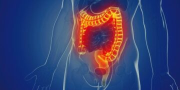 A Single Gene May Decide How Well Your Gut Fights Harmful Bacteria