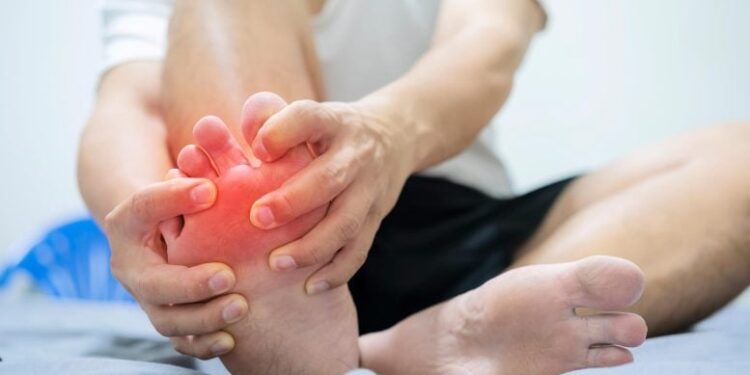 The Gout Advice Going Viral on TikTok Isn’t What Works