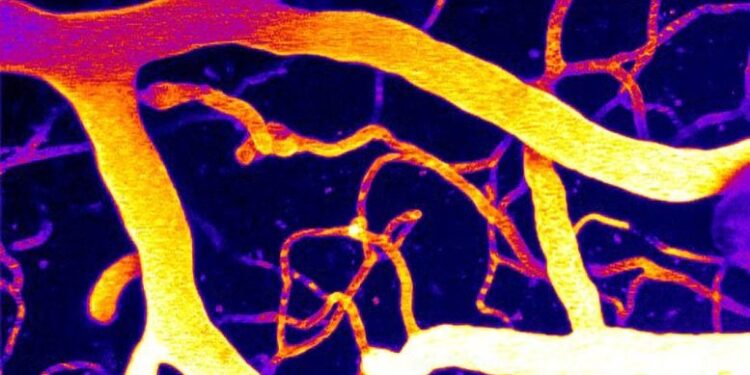 Brain Discovery Reveals a Potential New Way To Treat Dementia