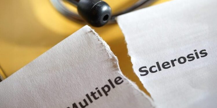 Hidden Brain Damage Found Years Before MS Diagnosis