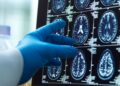 Menopause ‘triggers loss of brain matter which could explain women’s higher dementia risk’ | Science, Climate & Tech News