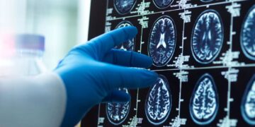 Menopause ‘triggers loss of brain matter which could explain women’s higher dementia risk’ | Science, Climate & Tech News