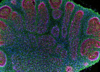 Brain organoids are helping researchers, but raise ethical questions : Shots