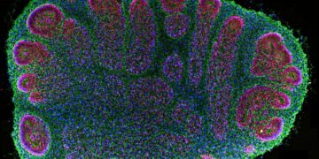 Brain organoids are helping researchers, but raise ethical questions : Shots