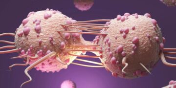 Colorectal Cancer Has a Unique Microbial “Fingerprint,” Scientists Discover