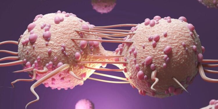 Colorectal Cancer Has a Unique Microbial “Fingerprint,” Scientists Discover