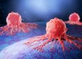 New Treatment Wipes Out Cancer Cells Without Harming Healthy Tissue