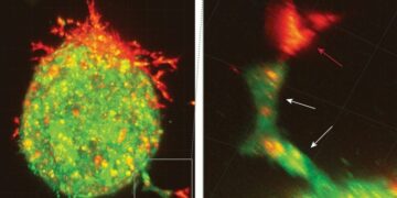 This Is How Ovarian Cancer Spreads Before Doctors Can Detect It