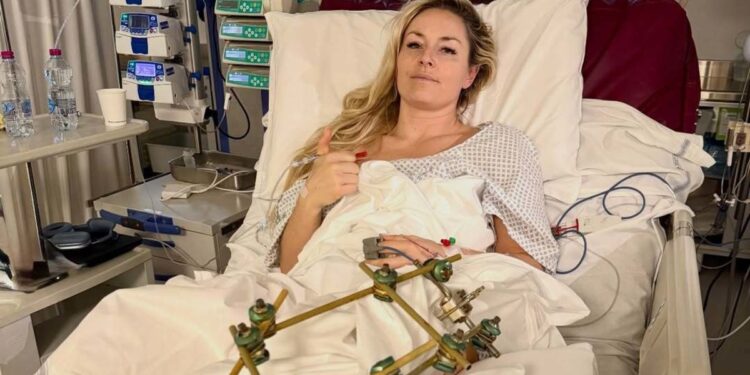 Lindsey Vonn injury update, photo, ‘successful’ surgery comments