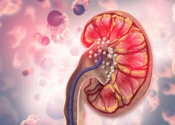 Why Drinking More Water Isn’t Enough To Stop Kidney Stones