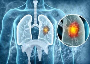 Scientists Uncover Aging Link That Could Change How Cancer Is Treated