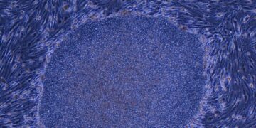 Japan Approves the World’s First Treatment Made With Reprogrammed Human Cells