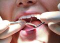 £8bn private dentistry industry to be investigated after ‘significant’ price hikes